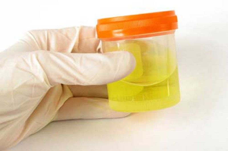 Seluruh Perangkat Desa di Indonesia Wajib Tes Urine!